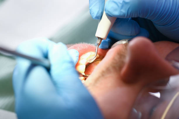 Urgent Tooth Repair in WI